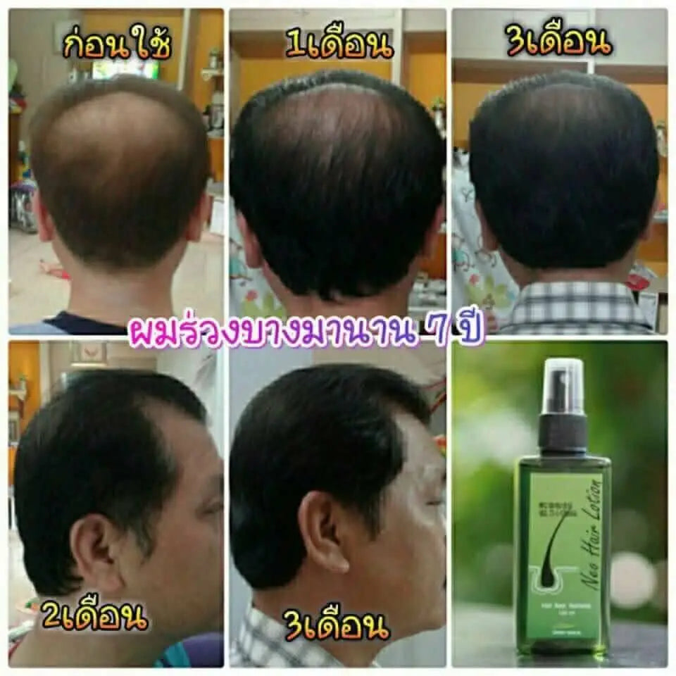 120ml Ne Hair Lotion Hair Root HAIR BEARD SIDEBURNS LONGER Herbs 100% Original Thailand Free Gift