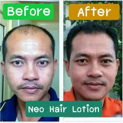 120ml Ne Hair Lotion Hair Root HAIR BEARD SIDEBURNS LONGER Herbs 100% Original Thailand Free Gift